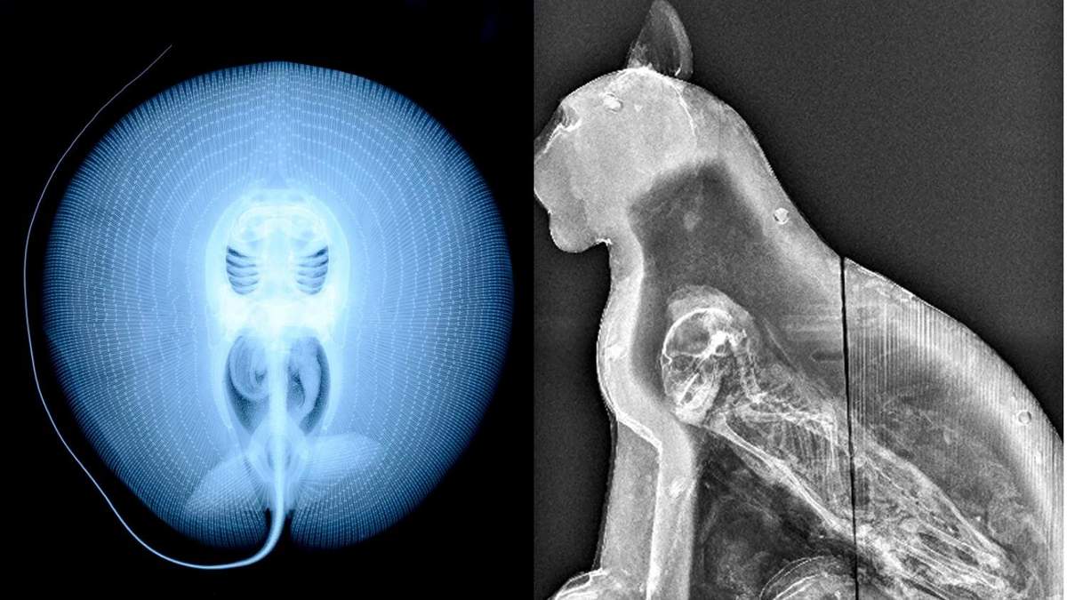  Самые странные рентгеновские снимки