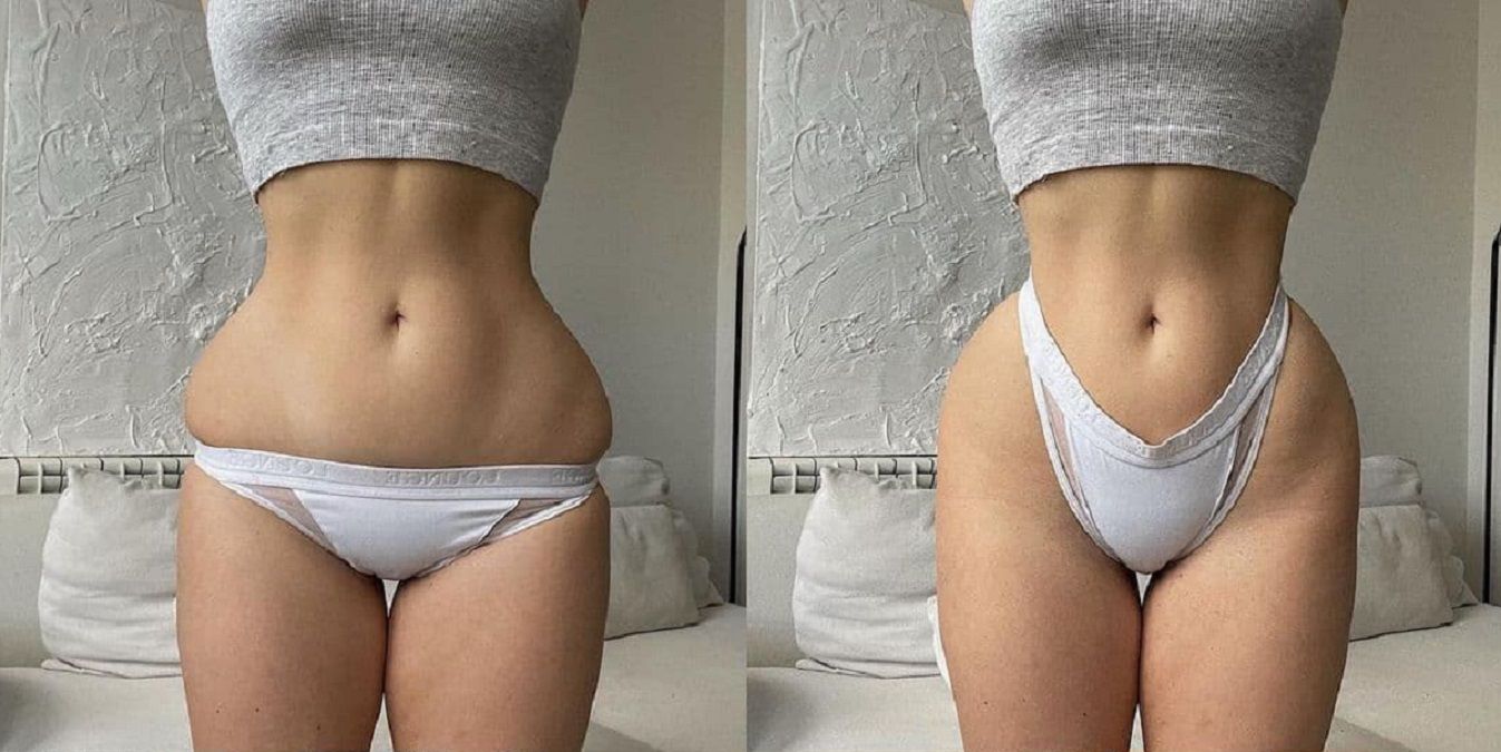 Весь секрет в позе: девушка показывает, как в жизни выглядят идеальные фигуры из инстаграма Весь секрет в позе: девушка показывает, как в жизни выглядят идеальные фигуры из инстаграма