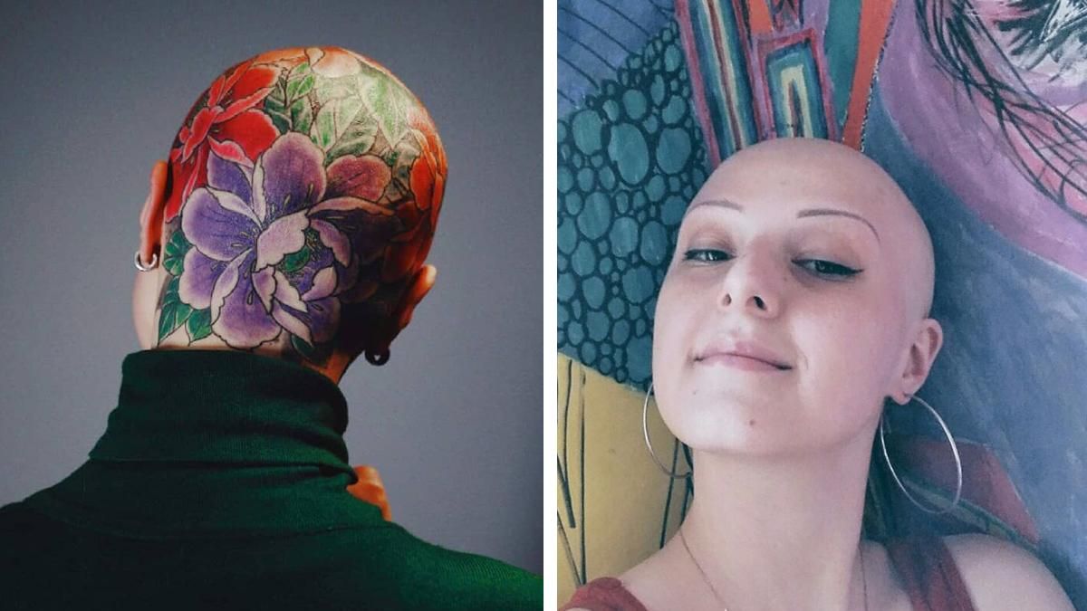 Женщина начала лысеть из-за болезни: теперь на ее голове растут цветы
