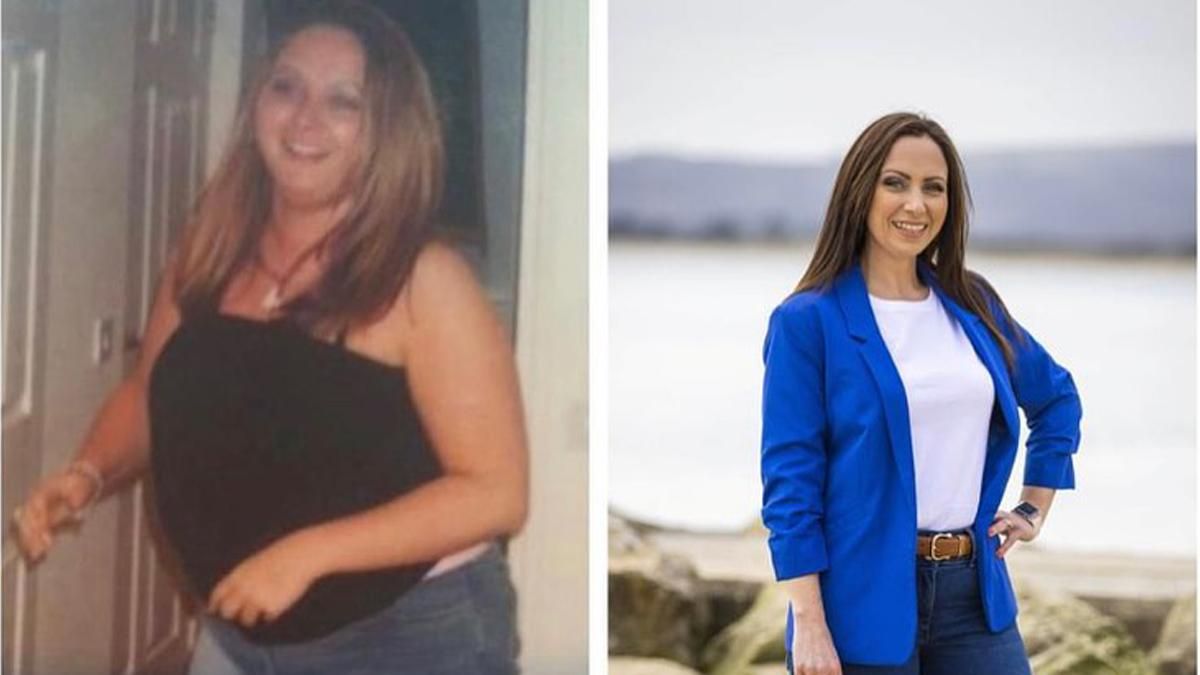 Женщина похудела на 40 килограмм и удивила всех – фото