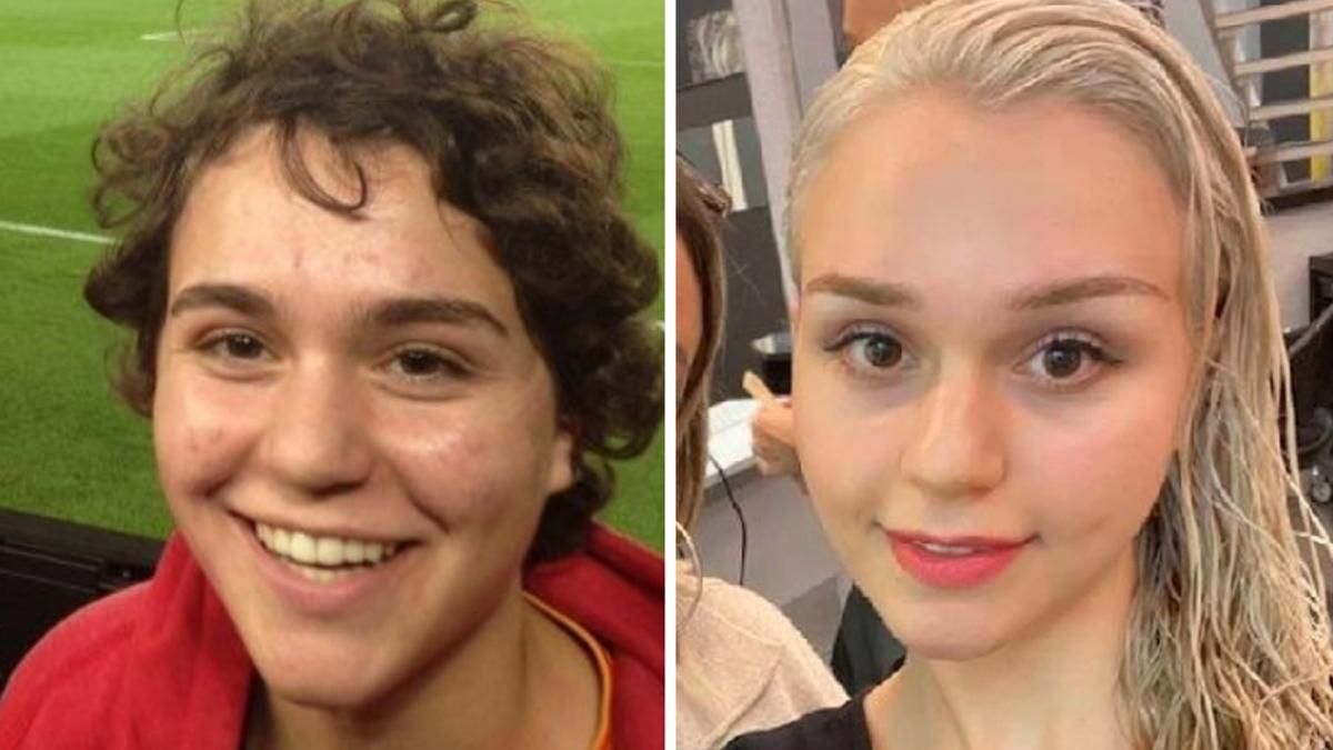 15 випадків, коли люди неймовірно змінювалися з роками: цікаві фото 15 випадків, коли люди неймовірно змінювалися з роками: цікаві фото