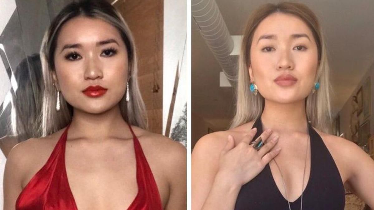 15 людей, які ризикнули піти на пластичну операцію: що з цього вийшло – фото 15 людей, які ризикнули піти на пластичну операцію: що з цього вийшло – фото