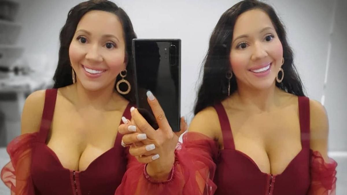 Один парень на двоих: как живут "самые похожие" близняшки в мире Один парень на двоих: как живут "самые похожие" близняшки в мире