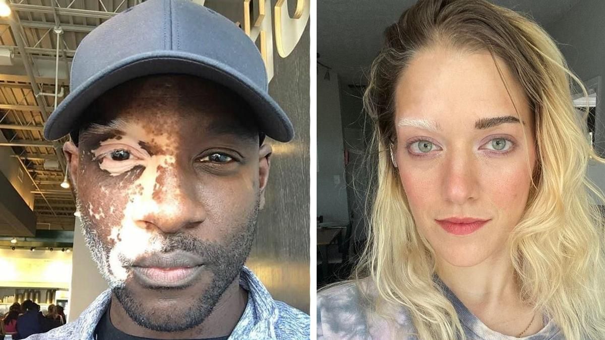 Дар природи: 15 людей із нестандартною зовнішністю, які вас здивують – фото Дар природи: 15 людей із нестандартною зовнішністю, які вас здивують – фото