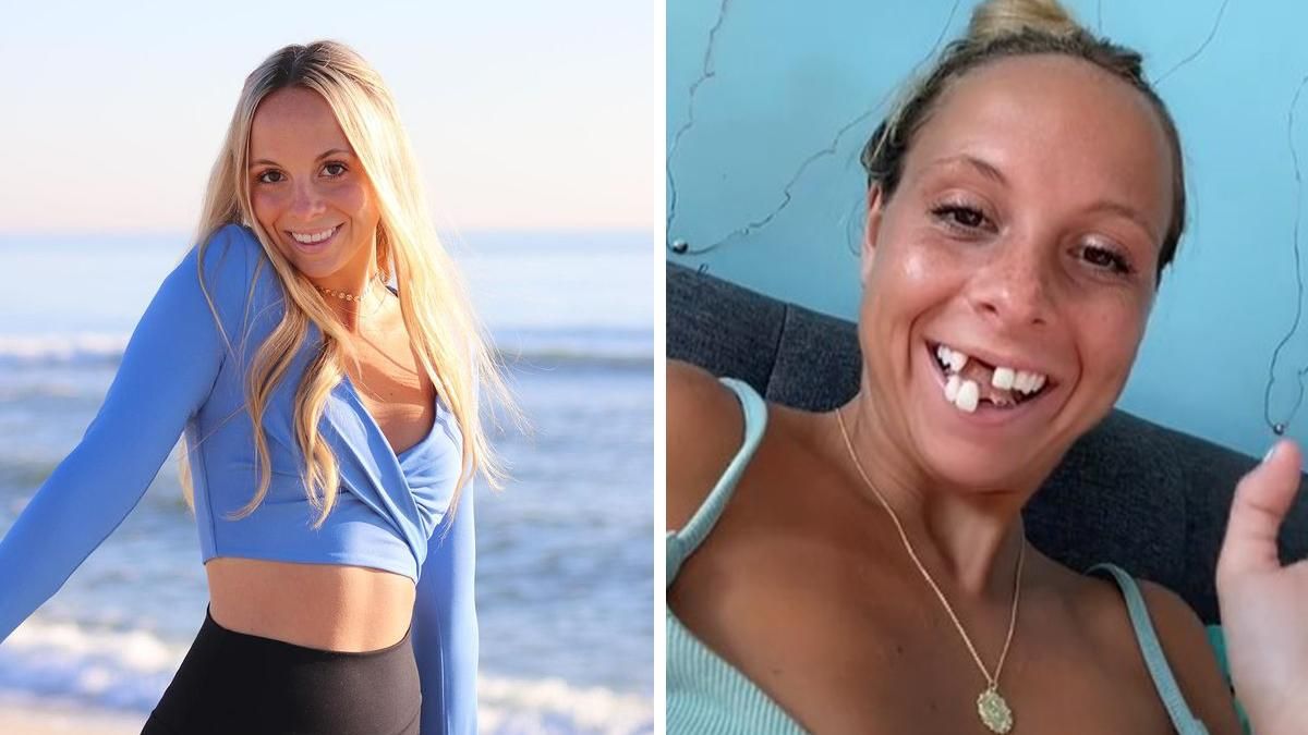 Жінка закохує хлопців своєю зовнішністю: у неї немає кількох зубів Жінка закохує хлопців своєю зовнішністю: у неї немає кількох зубів