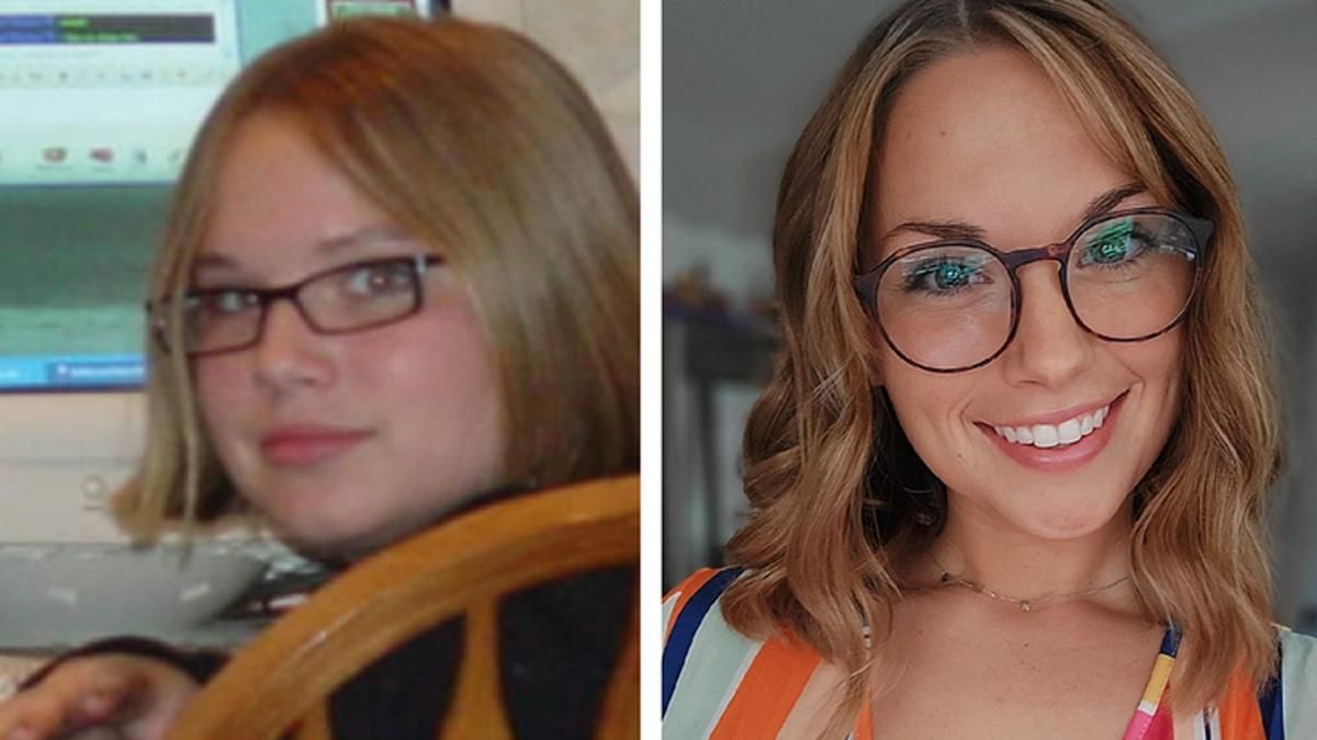 Їх ображали через зовнішність: 10 людей, які шалено змінилися з роками: фото Їх ображали через зовнішність: 10 людей, які шалено змінилися з роками: фото