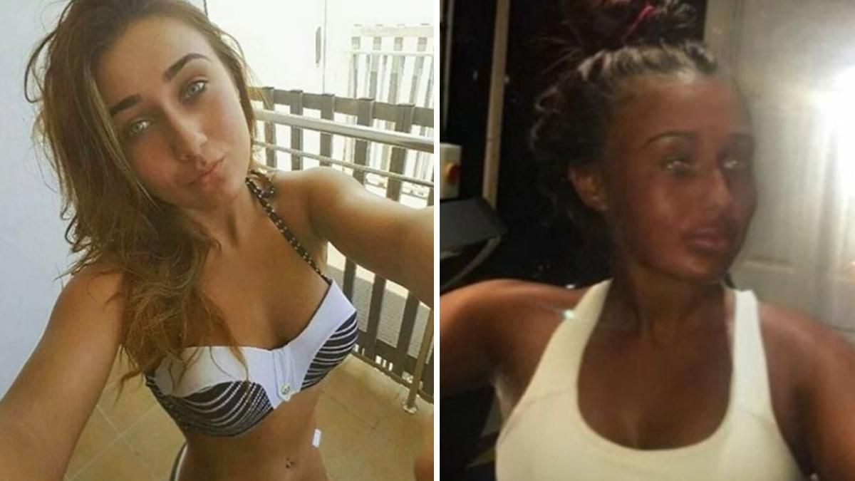 Женщина так перестаралась с загаром, что ее не узнала родная мама:фото Женщина так перестаралась с загаром, что ее не узнала родная мама:фото