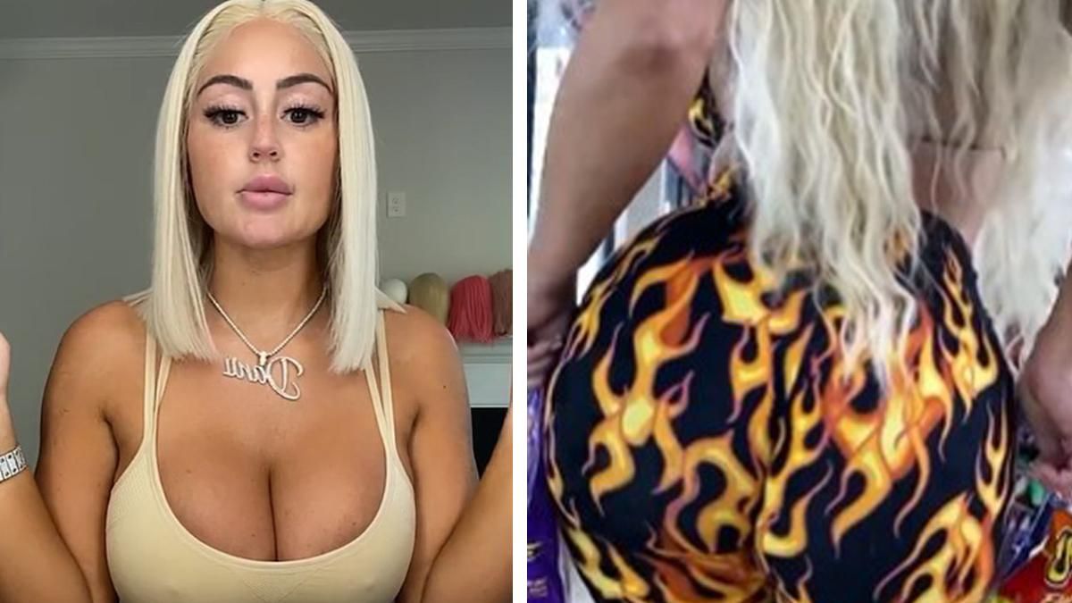 Модель витратила космічну суму на нові сідниці: лікарі благають її зупинитися Модель витратила космічну суму на нові сідниці: лікарі благають її зупинитися