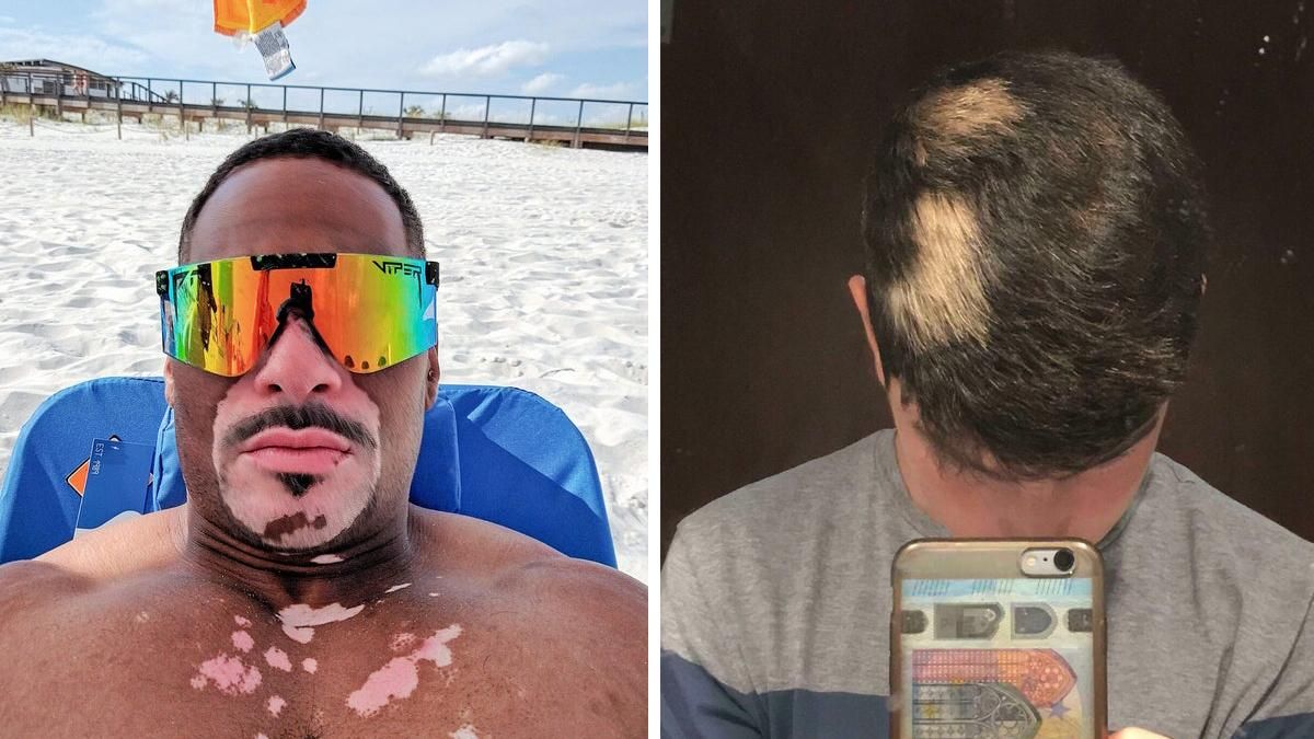 Неймовірно: 15 людей, які здивують вас унікальною зовнішністю – фото Неймовірно: 15 людей, які здивують вас унікальною зовнішністю – фото