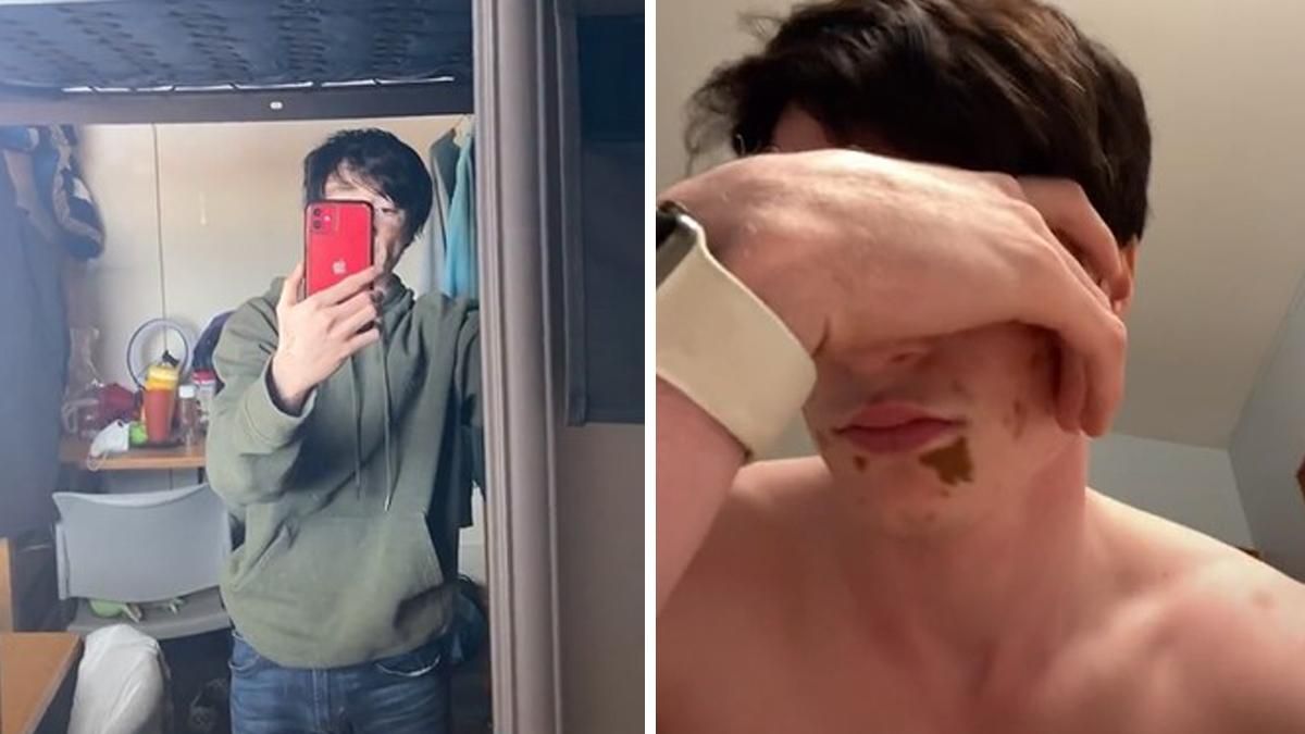 Мальчик внезапно побелел за несколько месяцев: как он изменился – фото Мальчик внезапно побелел за несколько месяцев: как он изменился – фото