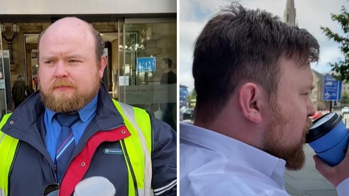 Мужчина убрал лысину и помолодел на 10 лет: крутое перевоплощения Мужчина убрал лысину и помолодел на 10 лет: крутое перевоплощения