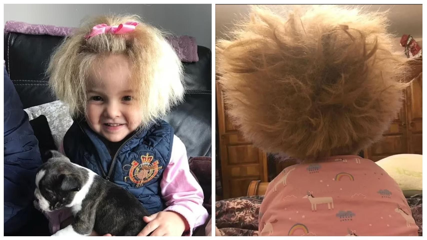 Дівчинку в мережі порівнюють з Айнштайном: все через її пухнасте волосся - Life Дівчинку в мережі порівнюють з Айнштайном: все через її пухнасте волосся - Life