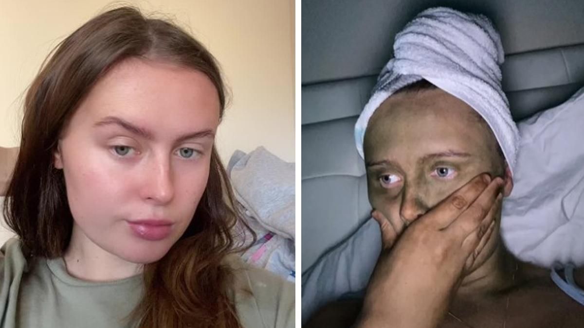 Девушка не узнала себя после крема для загара: она позеленела Девушка не узнала себя после крема для загара: она позеленела