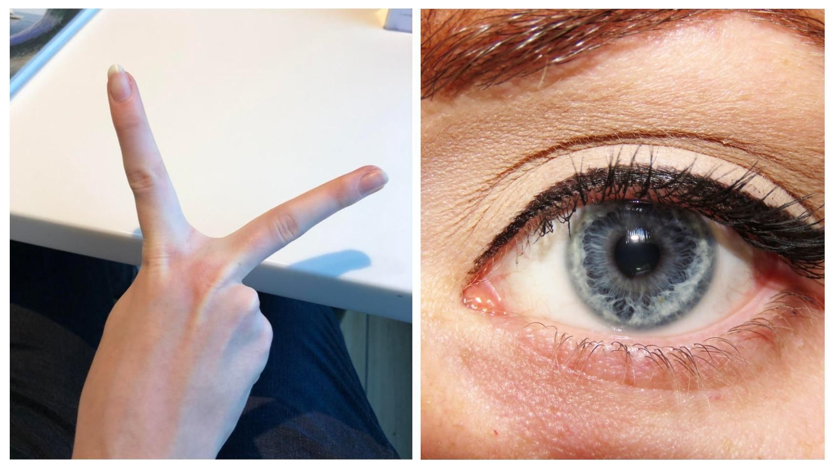 10+ людей, які виграли генетичну лотерею: особливості їх тіла збивають з пантелику - Life 10+ людей, які виграли генетичну лотерею: особливості їх тіла збивають з пантелику - Life