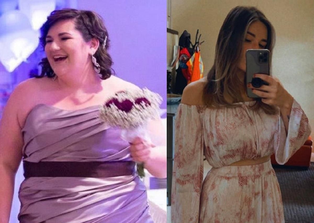 15 людей, які неймовірно змінились за кілька років: крута трансформація - Life 15 людей, які неймовірно змінились за кілька років: крута трансформація - Life