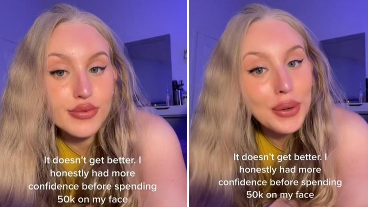 Дівчина витратила 50 тисяч доларів на пластичні операції: як вона змінилася - Life Дівчина витратила 50 тисяч доларів на пластичні операції: як вона змінилася - Life