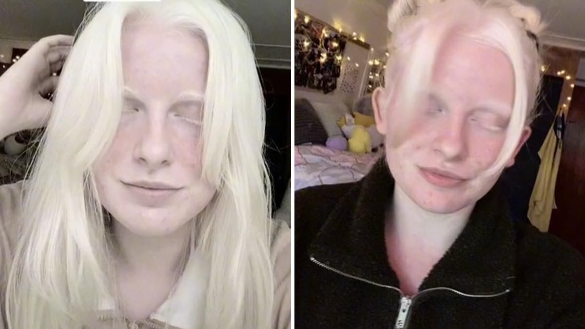 Сказочный цвет: девушка удивила миллионы людей своими глазами Сказочный цвет: девушка удивила миллионы людей своими глазами