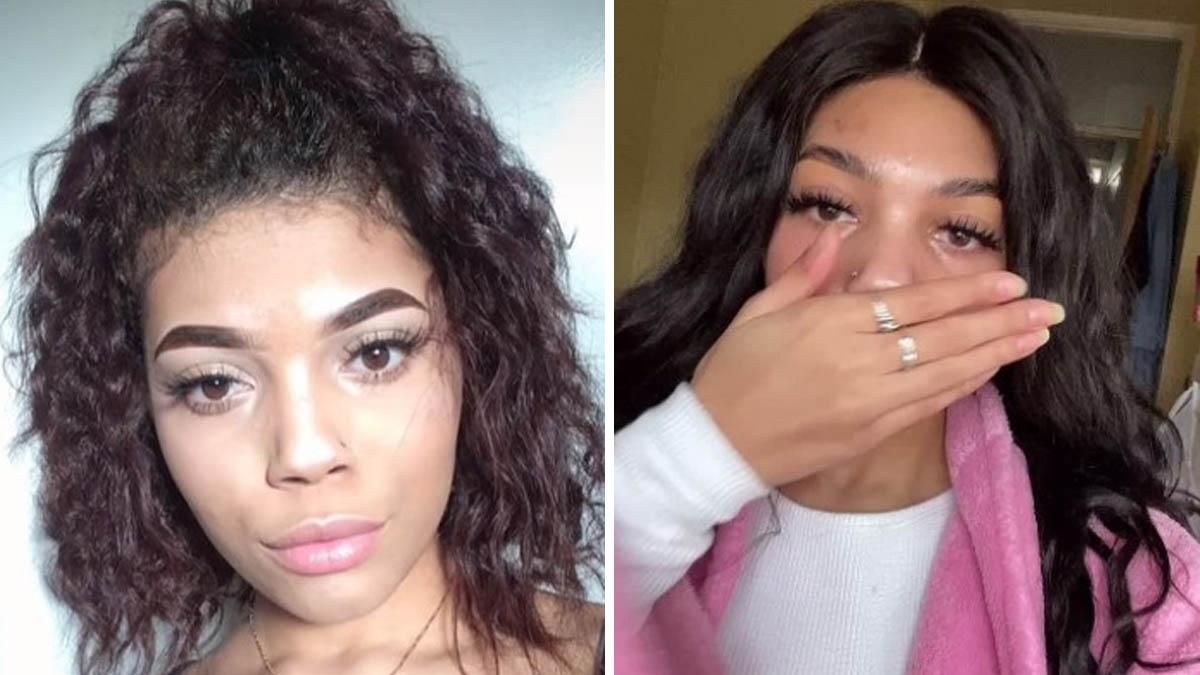 Девушка пять раз увеличивала свои губы: как она изменилась Девушка пять раз увеличивала свои губы: как она изменилась