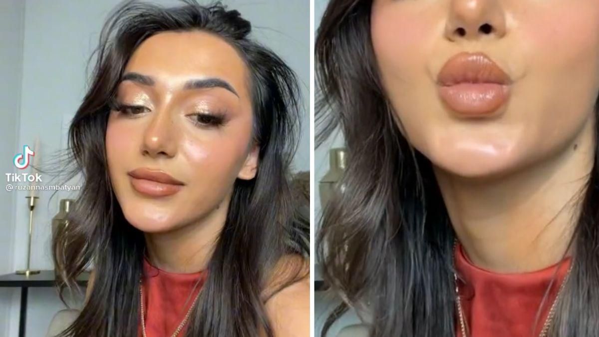 Хотела накачать губы, а увеличила подбородок: девушка не собирается останавливаться - Life Хотела накачать губы, а увеличила подбородок: девушка не собирается останавливаться - Life