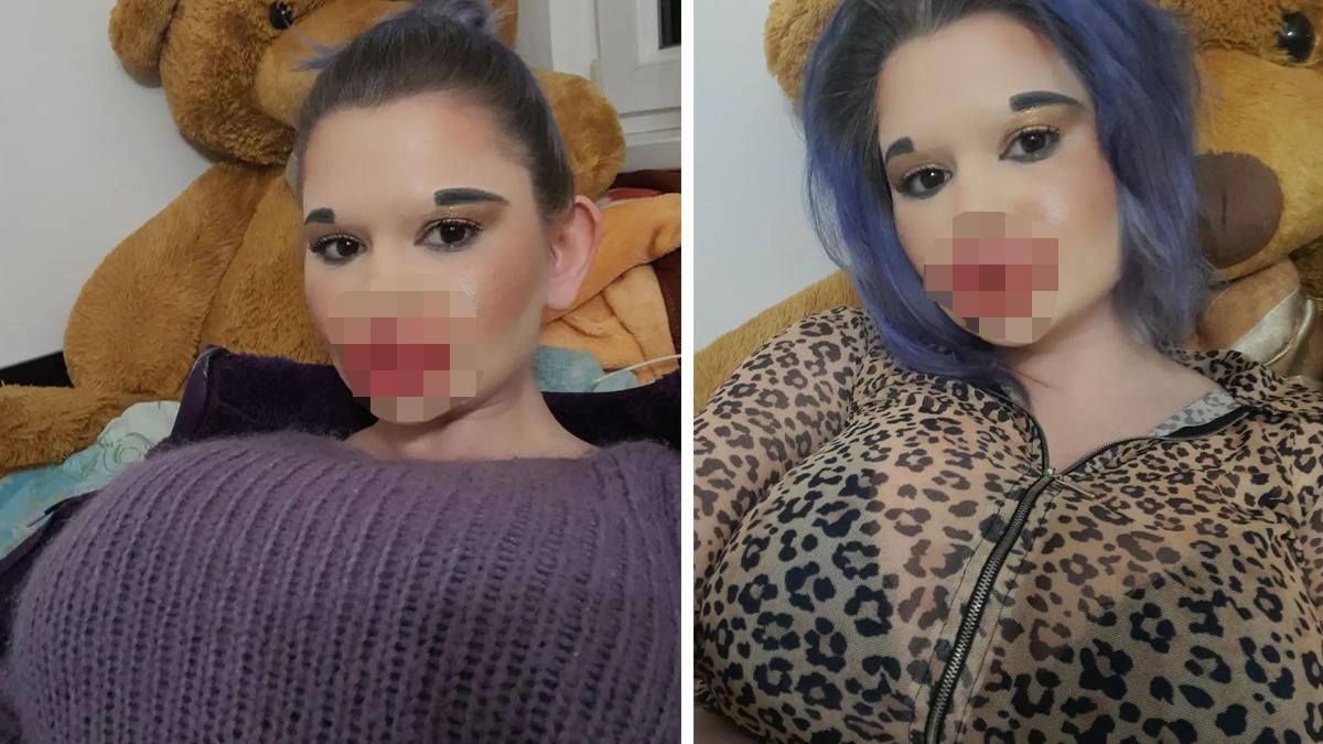 У красоты нет границ: девушка 26 раз увеличивала свои губы У красоты нет границ: девушка 26 раз увеличивала свои губы