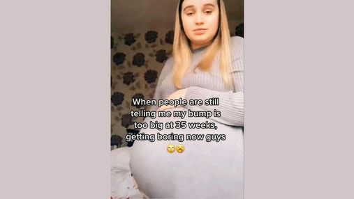 Дівчина соромиться свого живота: вона на 35 тижні вагітності