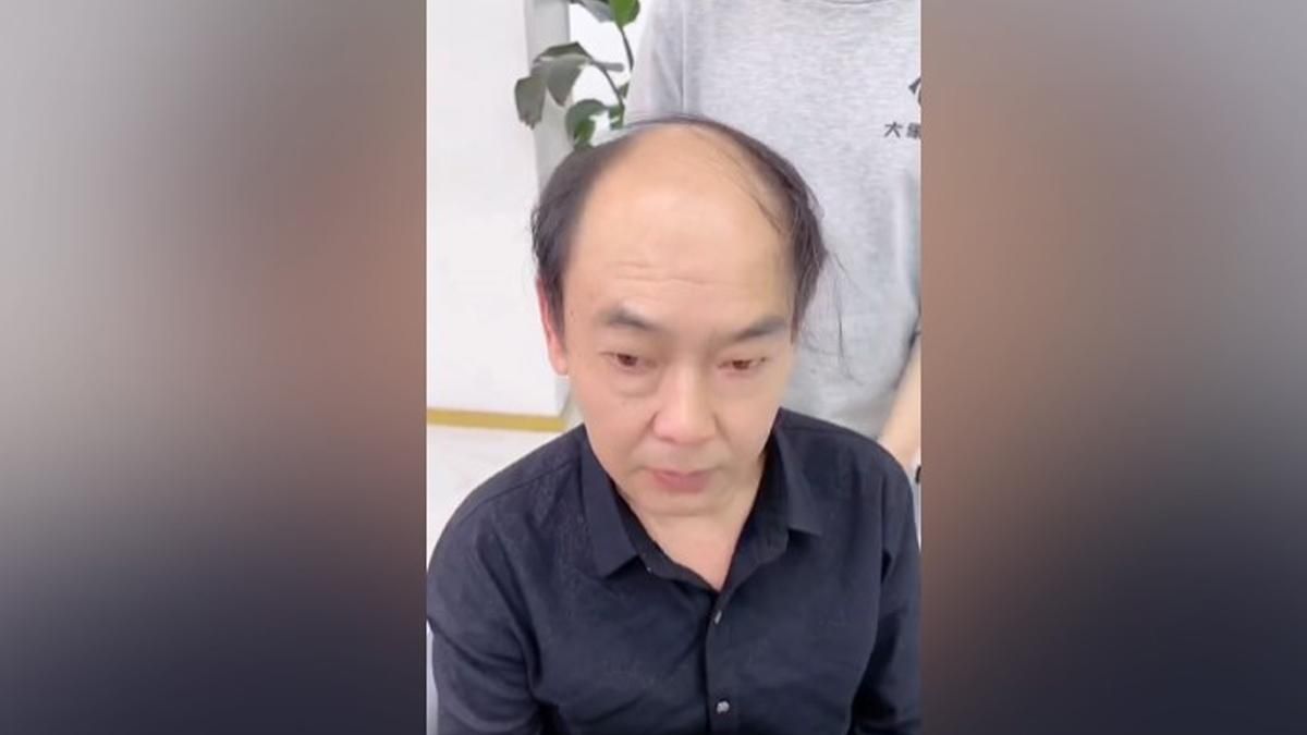 Помолодел на 20 лет: мужчина оригинально избавился от лысины Помолодел на 20 лет: мужчина оригинально избавился от лысины