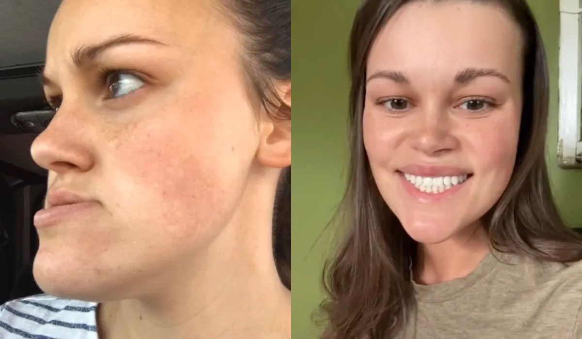 Благодаря операции девушка преодолела свой самый большой комплекс Благодаря операции девушка преодолела свой самый большой комплекс