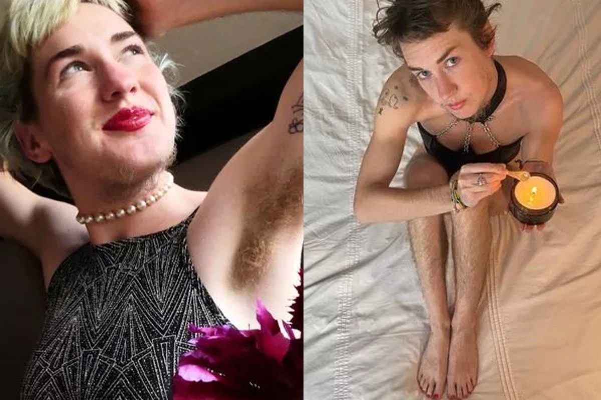 Проблемы с ростом волос у женщины начались еще в подростковом возрасте Проблемы с ростом волос у женщины начались еще в подростковом возрасте