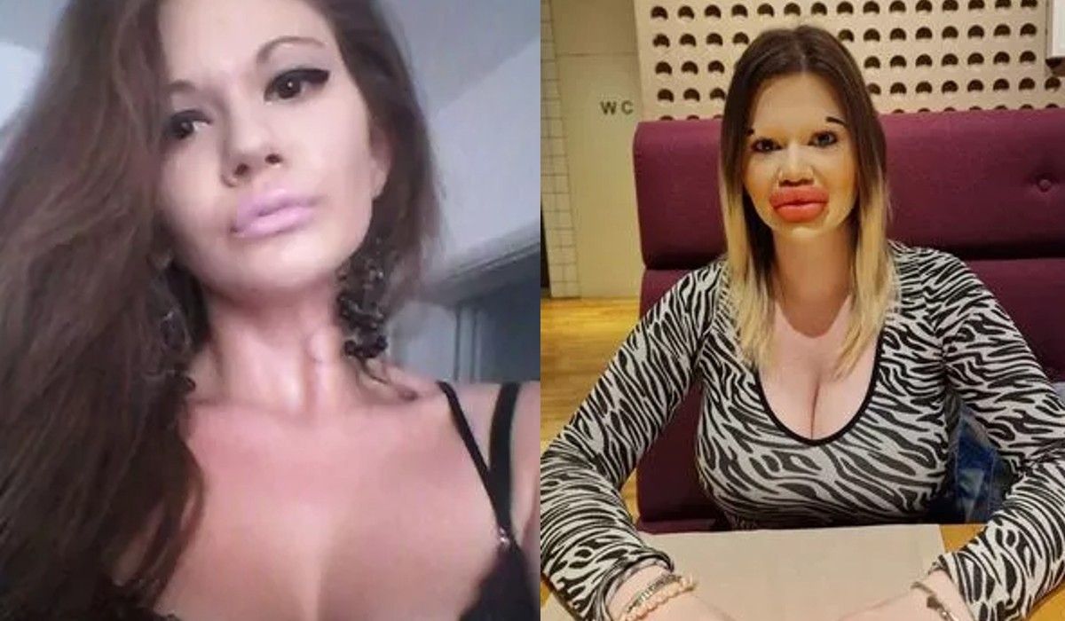 Женщина начала делать губы еще в 2018 году Женщина начала делать губы еще в 2018 году