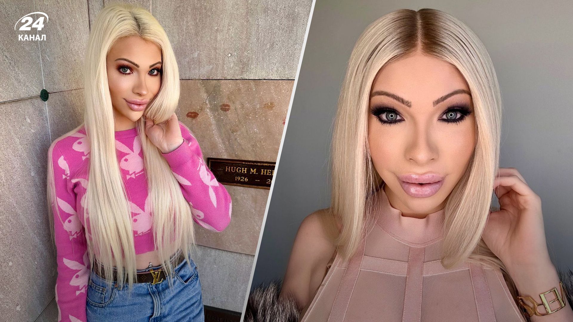 Девушка сделала десятки операций, чтобы быть похожей на Мэрилин Монро Девушка сделала десятки операций, чтобы быть похожей на Мэрилин Монро