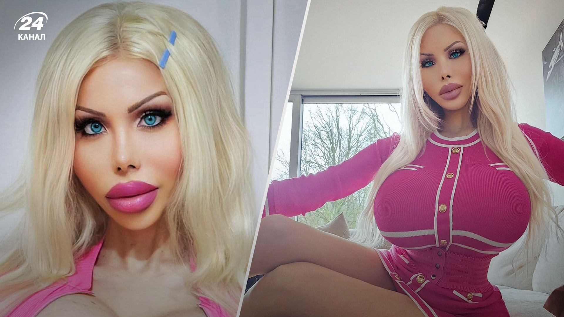 28-летняя девушка сделала десятки операций, чтобы быть похожей на Барби